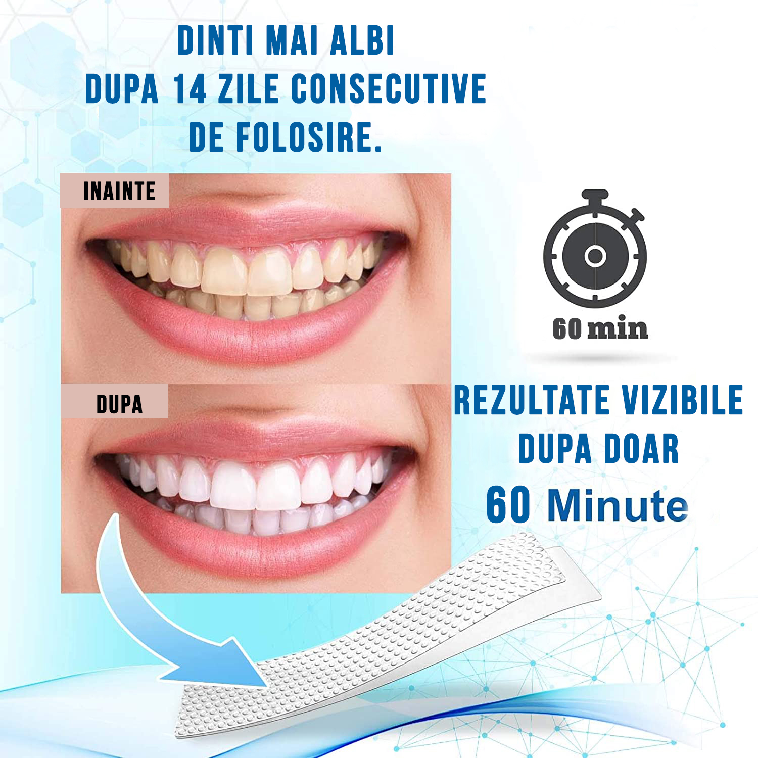 Set Benzi pentru albirea dintilor, Fara peroxid, 14 plicuri, 65 g - foto 9